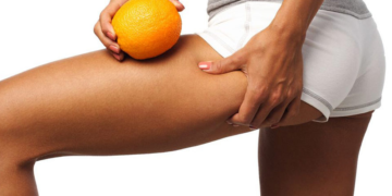 Selülitle Savaşan Gıdalar