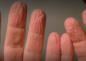 Parmaklar Suda Kalınca Neden Buruşur?