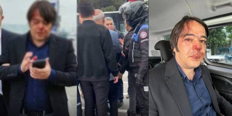 Üsküdar’da Kaçak Kafelerin Yıkımı Sürüyor… İBB Yetkilisini Darbettiler