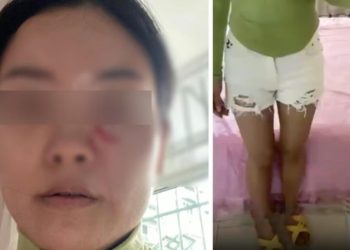 Gelininin şortunu kısa bulan kayınpeder öfkeden mecnuna döndü! Sıcak çorbayı başından aşağı döküp tehditler savurdu