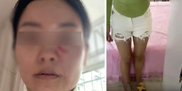 Gelininin şortunu kısa bulan kayınpeder öfkeden mecnuna döndü! Sıcak çorbayı başından aşağı döküp tehditler savurdu