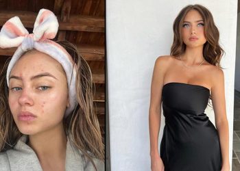 Genç model için “annesinden torpilli” diyorlar: Yüzünün gerçek halini makyajsız selfie’siyle paylaştı