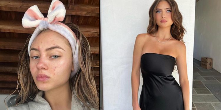 Genç model için “annesinden torpilli” diyorlar: Yüzünün gerçek halini makyajsız selfie’siyle paylaştı