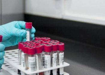 İngiltere’de bulaşıcı cinsel hastalıklar rekor düzeye yükseldi