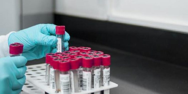 İngiltere’de bulaşıcı cinsel hastalıklar rekor düzeye yükseldi