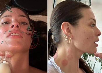 Ne botoks ne de dolgu… Ünlü model milyonlarca takipçisine hoşluk sırrını verdi!