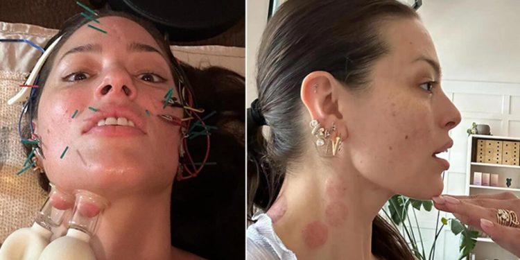 Ne botoks ne de dolgu… Ünlü model milyonlarca takipçisine hoşluk sırrını verdi!