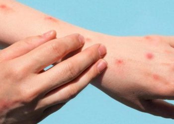 Pekin’de maymun çiçeği virüsü nedeniyle 2 kişi karantinaya alındı