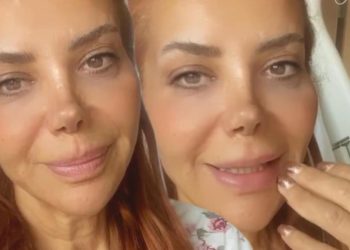 Tanyeli sıhhat durumu takipçileri ile paylaştı: Saçlar biraz gidecek, bu o denli bir seyahat…