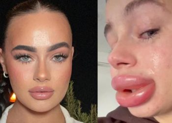 Ücretsiz dolgu kabusundan sıkıntı uyandı