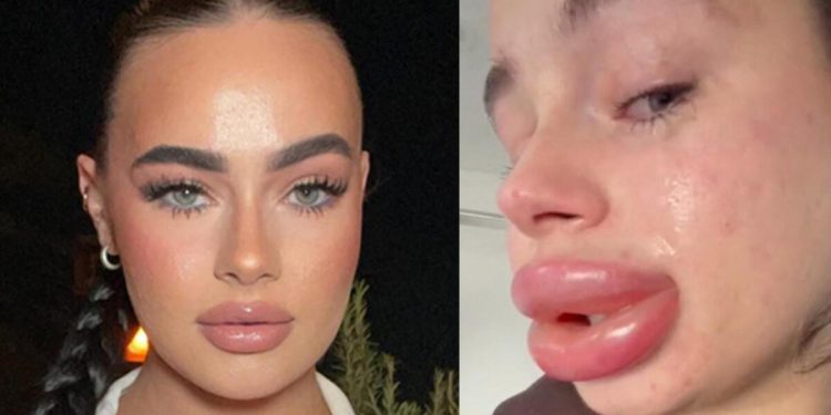 Ücretsiz dolgu kabusundan sıkıntı uyandı