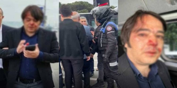 Üsküdar’da İBB Yetkilisi Taarruza Uğramıştı: 2 Gözaltı