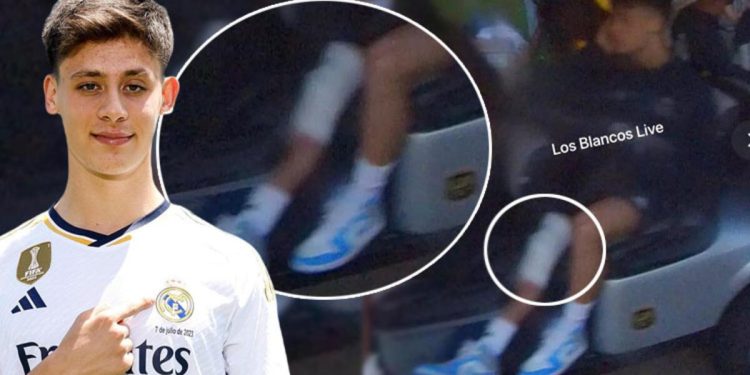 Arda Güler sakatlandı! Real Madrid – Milan maçında oynayabilecek mi?