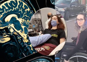 Gizemli beyin hastalığı paniğe neden oldu! Hadise sayısı artıyor…