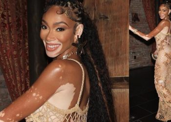 Herkesin alay ettiği günler geride kaldı: Hastalığı talihi oldu, hayatını değiştirdi