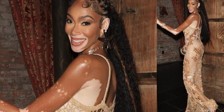 Herkesin alay ettiği günler geride kaldı: Hastalığı talihi oldu, hayatını değiştirdi