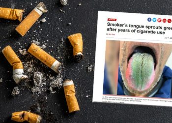 Lisanı bir anda tüylenmeye başladı ve yeşile döndü! Sebebi tıp mecmuasına mevzu oldu