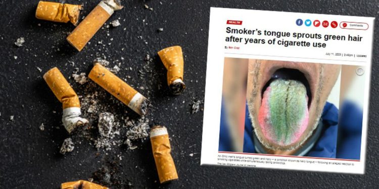 Lisanı bir anda tüylenmeye başladı ve yeşile döndü! Sebebi tıp mecmuasına mevzu oldu