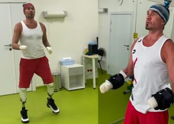 Şampiyon atletin trajedisi: Hem bacaklarını, hem ellerini kaybetti… Geriye içindeki umut kaldı