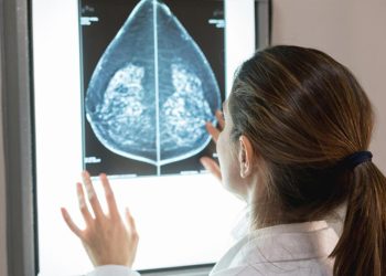 Yapay zeka göğüs kanseri tespitinde başarılı oldu! Olağan teşhis süreciyle tıpkı…