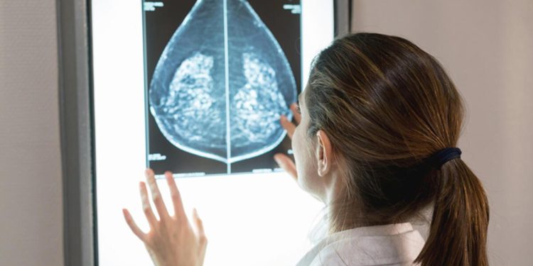 Yapay zeka göğüs kanseri tespitinde başarılı oldu! Olağan teşhis süreciyle tıpkı…