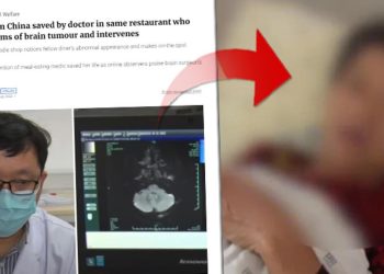 Yemek yediği restorandaki bir yabancı görünüşüne bakıp teşhis koydu: ‘Beyninizde tümör olabilir’