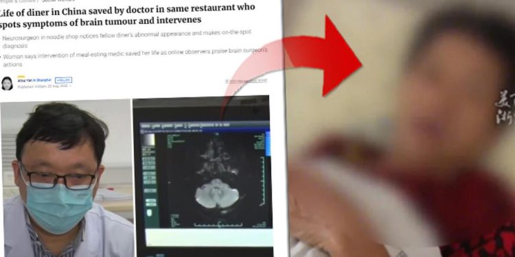 Yemek yediği restorandaki bir yabancı görünüşüne bakıp teşhis koydu: ‘Beyninizde tümör olabilir’