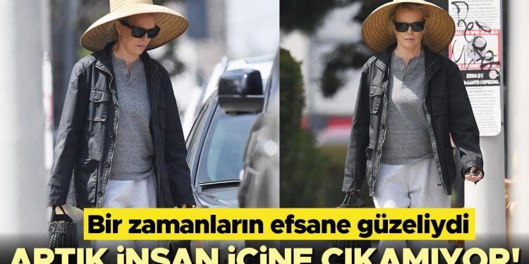 Bir vakitlerin efsane güzeliydi… Artık insan içine çıkamıyor!