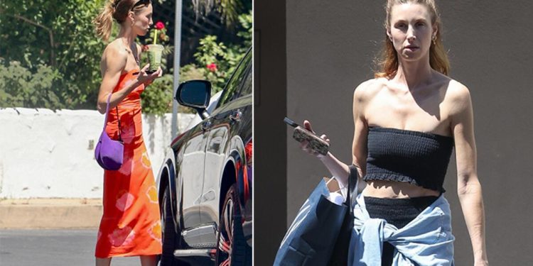 Çok zayıfladığı için kocası onu artık cazip görmediğini söylemişti: Ünlü oyuncunun yüzü hiç gülmüyor