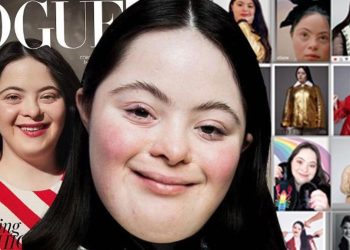 Hekimler ‘asla yürüyemez ve konuşamaz’ dedi, hemşire hastanede terk etmelerini önerdi! Herkese meydan okuyup 21 yaşında Vogue mecmuasına kapak oldu