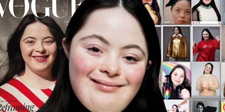 Hekimler ‘asla yürüyemez ve konuşamaz’ dedi, hemşire hastanede terk etmelerini önerdi! Herkese meydan okuyup 21 yaşında Vogue mecmuasına kapak oldu