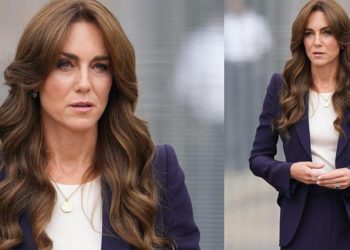 Herkes saçlarına bakıyordu fakat… Kate kötü düşmüş!