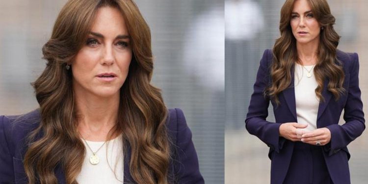 Herkes saçlarına bakıyordu fakat… Kate kötü düşmüş!