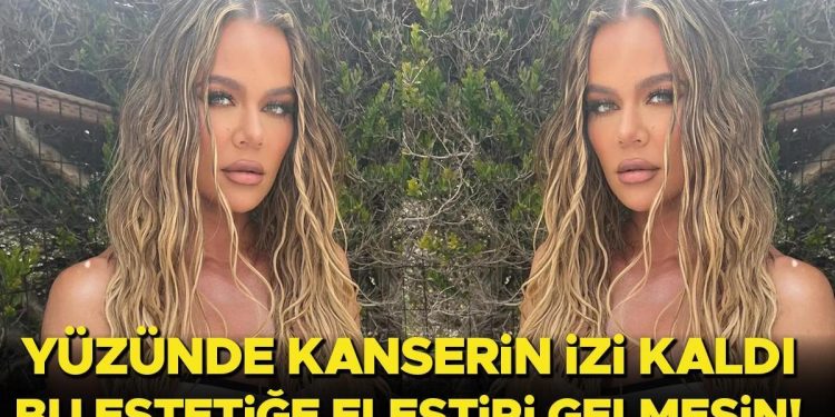 Kanseri yendi lakin izini yüzünde taşıdı… Bu defa estetiği mecbur kalıp yaptırdı