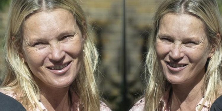 Som altından heykeli bile yapılmıştı… Yaşadığı süratli hayat hoşluğunu aldı: Efsaneler de çöker!