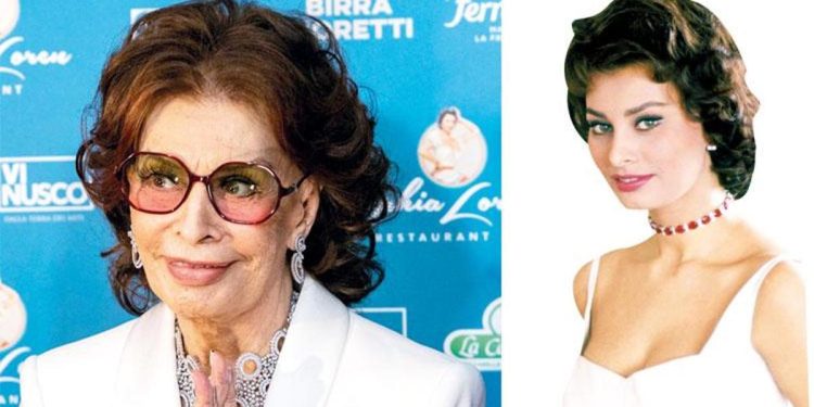 Sophia Loren kaza geçirdi