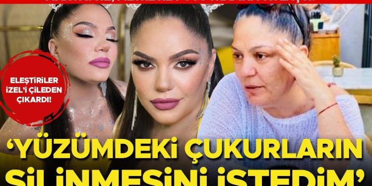 Tenkitler İzel’i sıkıntıdan çıkardı: Yüzümdeki çukurların silinmesini istedim!