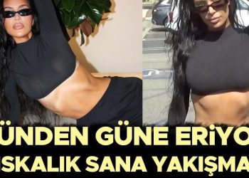 Her geçen gün eriyor… Hayranları telaşlı: Sıskalık sana yakışmıyor!