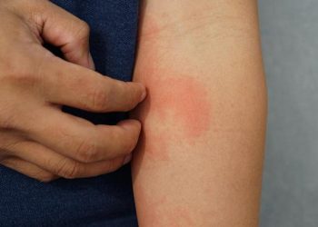 Kaşıntı için gittiği hastanede makus haberi öğrendi! İşte saklı hastalığı ve ele veren belirtisi…