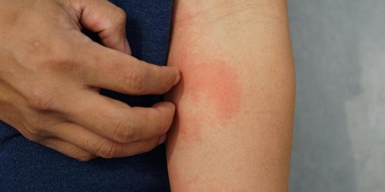 Kaşıntı için gittiği hastanede makus haberi öğrendi! İşte saklı hastalığı ve ele veren belirtisi…