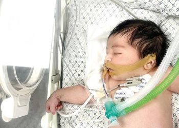 Mekke bebek hayata tutundu… Atakta ölen annesinin karnından çıkarıldı