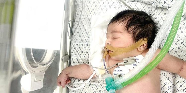 Mekke bebek hayata tutundu… Atakta ölen annesinin karnından çıkarıldı