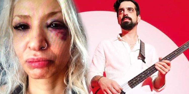 Şoke eden argüman… Müzisyen Can Tunaboylu sevgilisi Aybike Çelik’e şiddet uyguladı!