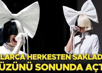 Ünlü müzikçiden estetik itirafı: Yıllardır kocaman peruklarla sakladığı yüzünü sonunda açtı