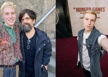 Dört yaşında geçirdiği vahim kazada kolunu kaybetmişti… Artık Hollywood yıldızlarıyla başrolde perdede!