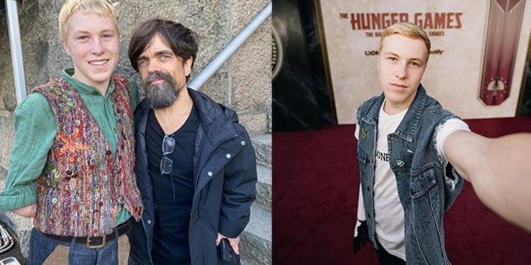 Dört yaşında geçirdiği vahim kazada kolunu kaybetmişti… Artık Hollywood yıldızlarıyla başrolde perdede!