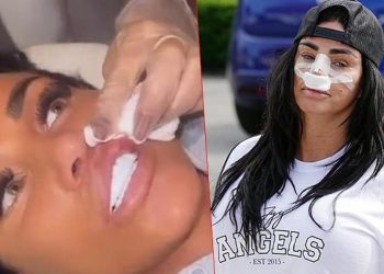 Estetik bağımlısı ünlü isim kendini durduramıyor… Bu uğurda iflas etti ancak yeniden tabibin yolunu tuttu