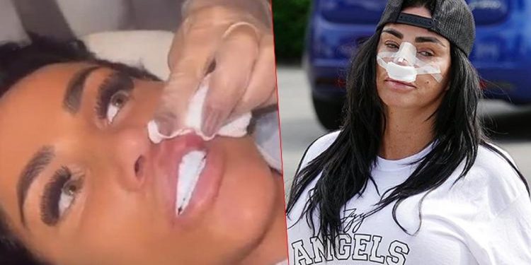 Estetik bağımlısı ünlü isim kendini durduramıyor… Bu uğurda iflas etti ancak yeniden tabibin yolunu tuttu