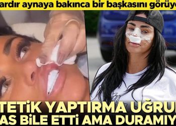 Estetik bağımlısı ünlü isim kendini durduramıyor… Bu uğurda iflas etti lakin tekrar hekimin yolunu tuttu