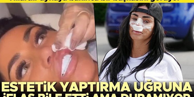 Estetik bağımlısı ünlü isim kendini durduramıyor… Bu uğurda iflas etti lakin tekrar hekimin yolunu tuttu